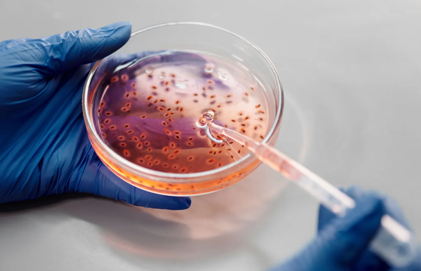 Find a preclinical model